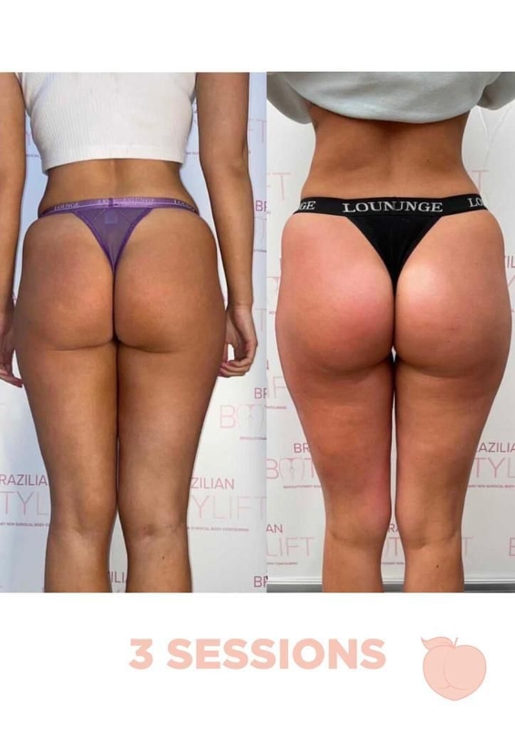 Image 2 from Miami Peach Body Contouring Clinic