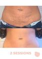 Thumbnail image 3 from Miami Peach Body Contouring Clinic