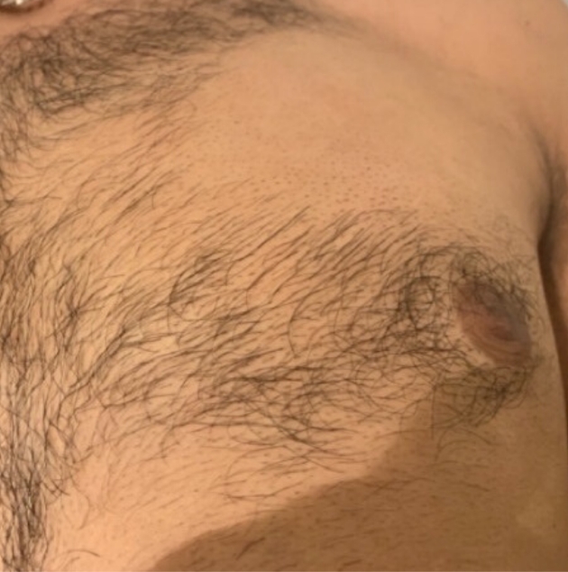 Get big-day ready with fast, effective and long-lasting hair removal: Image 2