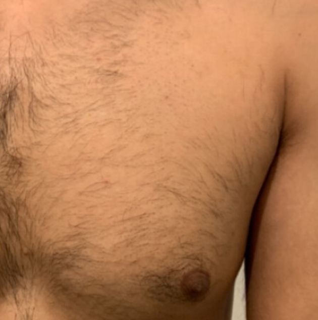 Get big-day ready with fast, effective and long-lasting hair removal: Image 2