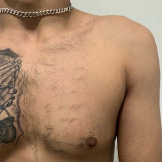 Get big-day ready with fast, effective and long-lasting hair removal: Image 4