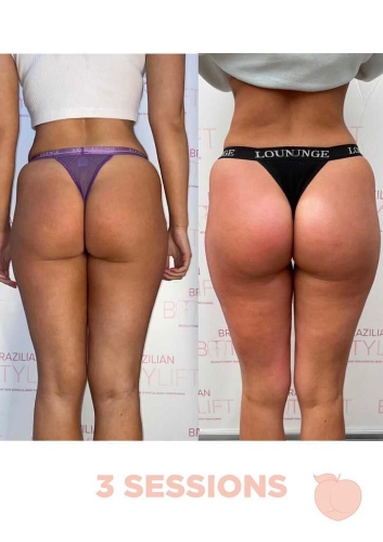 Image 3 from Miami Peach Body Contouring Clinic