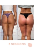 Thumbnail image 3 from Miami Peach Body Contouring Clinic